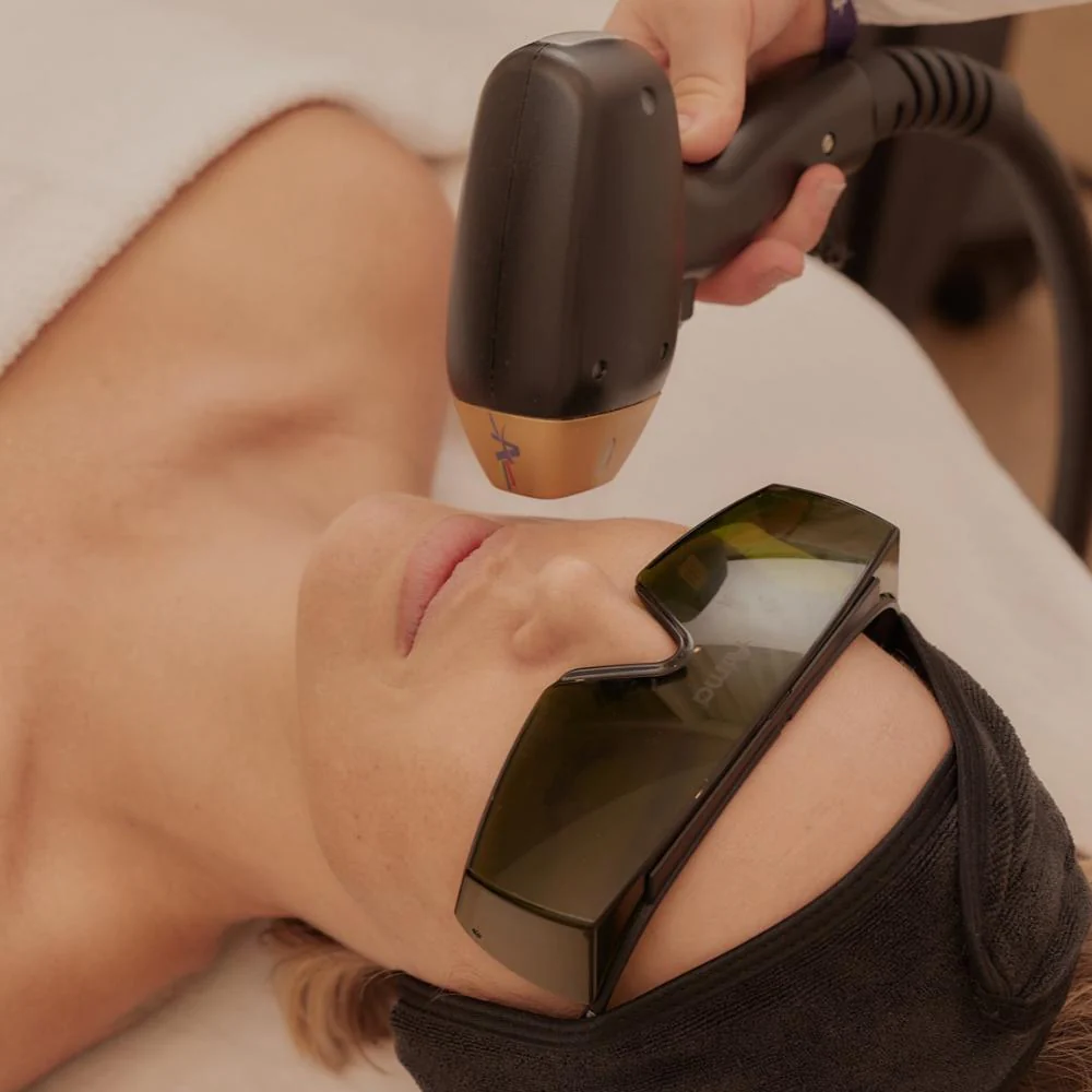 Depilação a laser na Estética Rauen